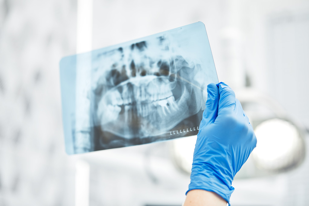 Oralchirurgie in der Zahnarztpraxis Kipper aus Bochum