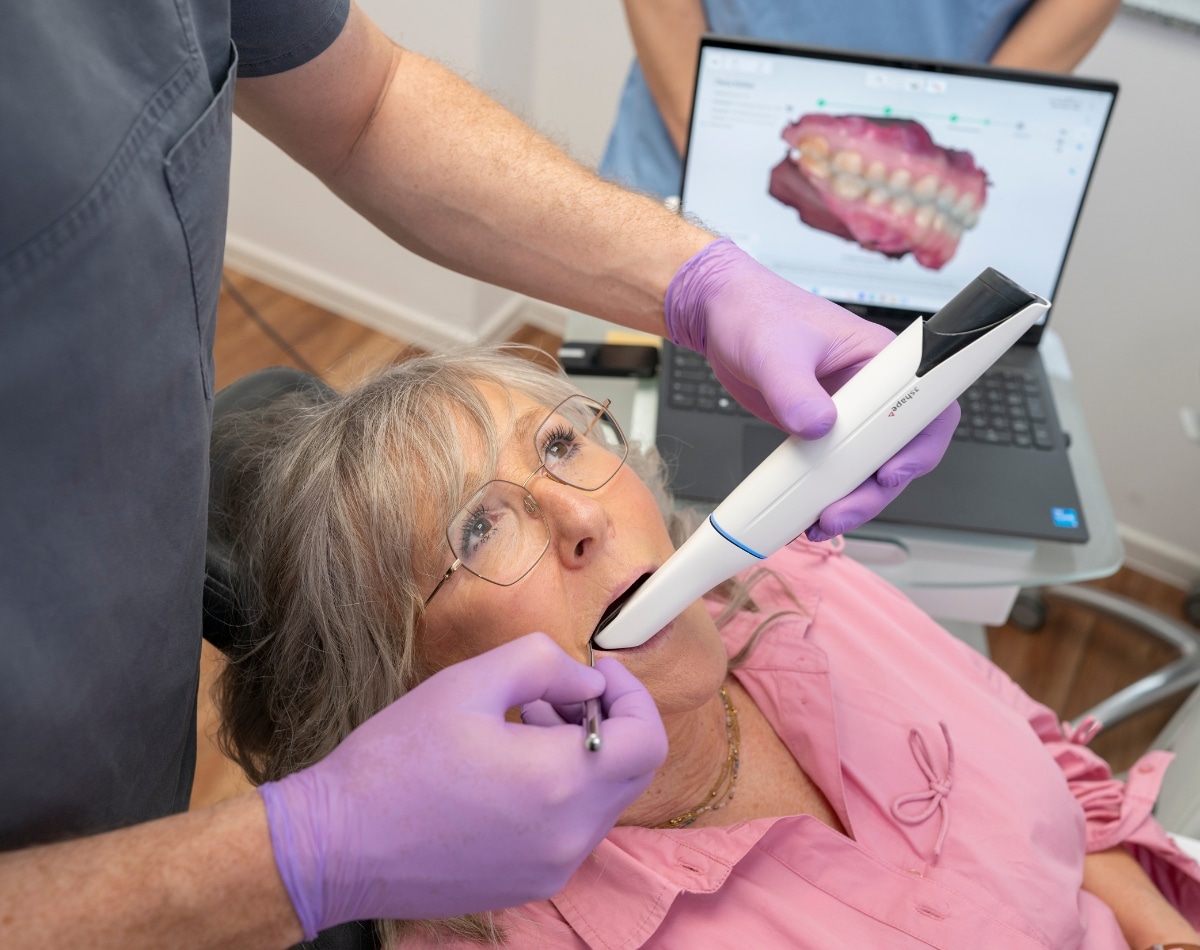 intraoralscanner-digitale-abformung Digitale Abformung mit dem Intraoralscanner